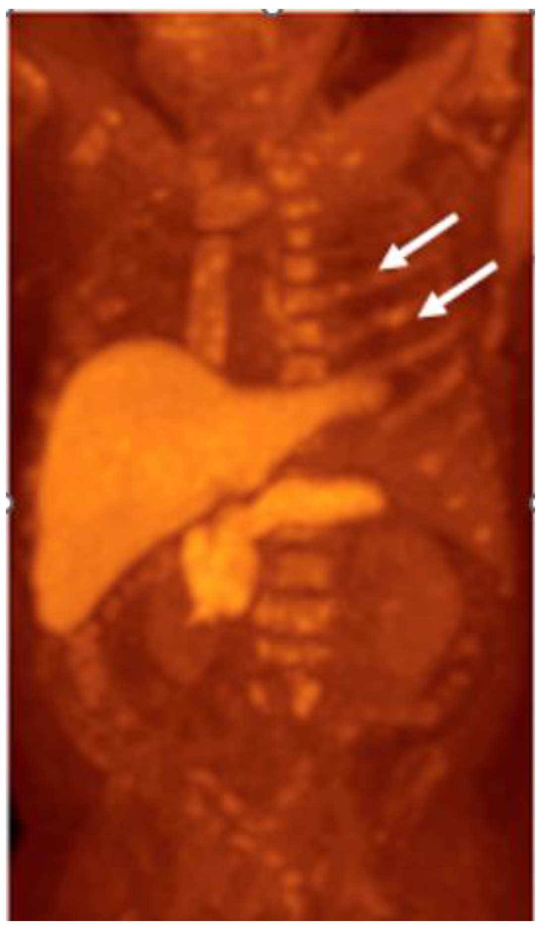 Cancers 15 00796 g010