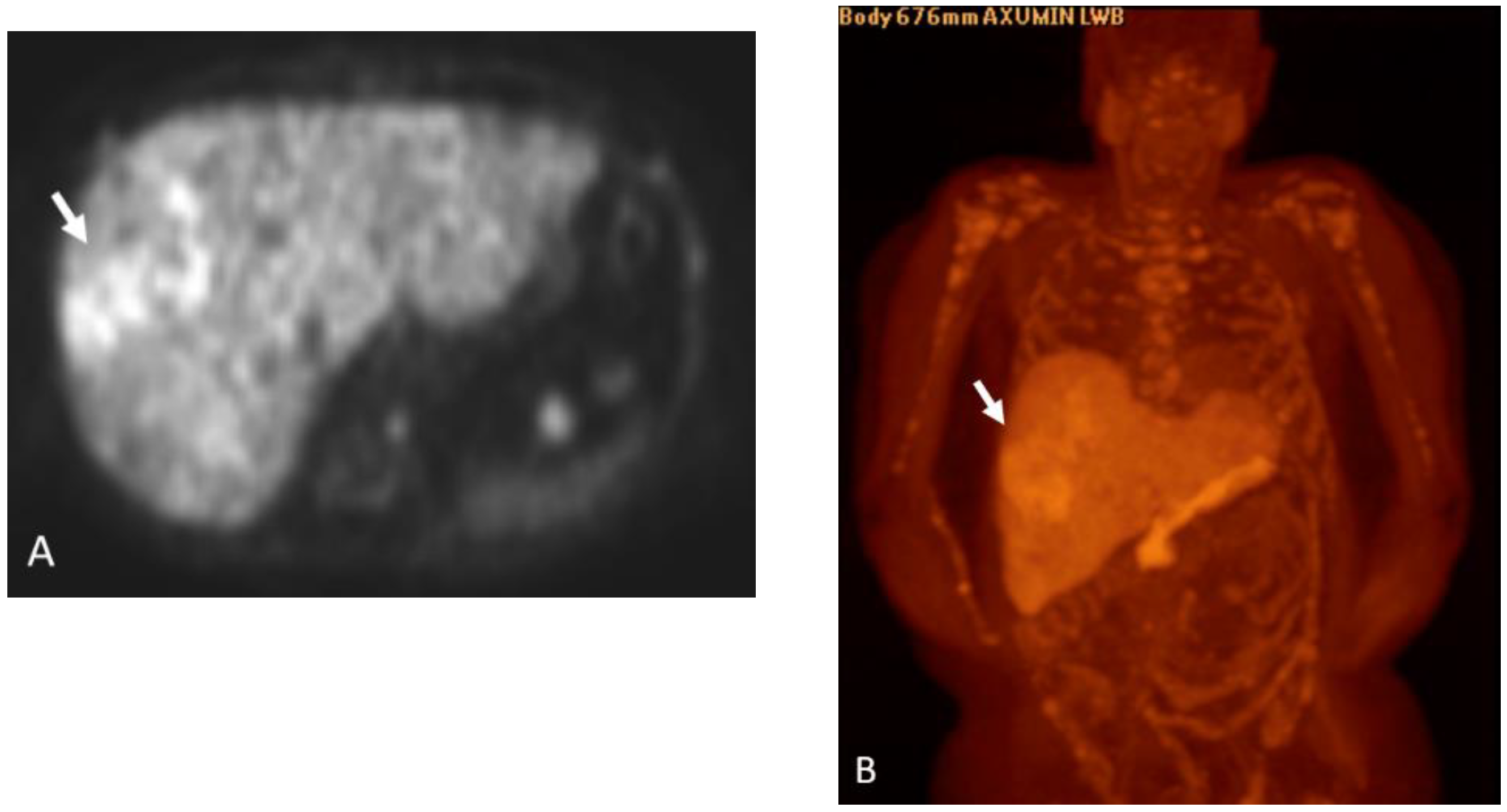 Cancers 15 00796 g011