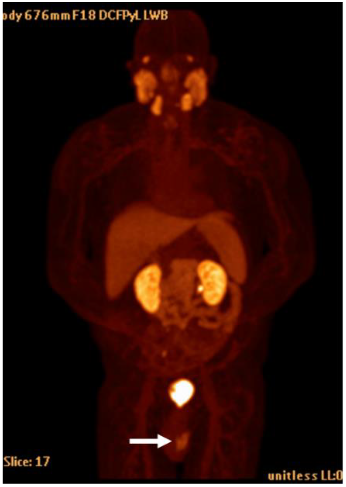 Cancers 15 00796 g013