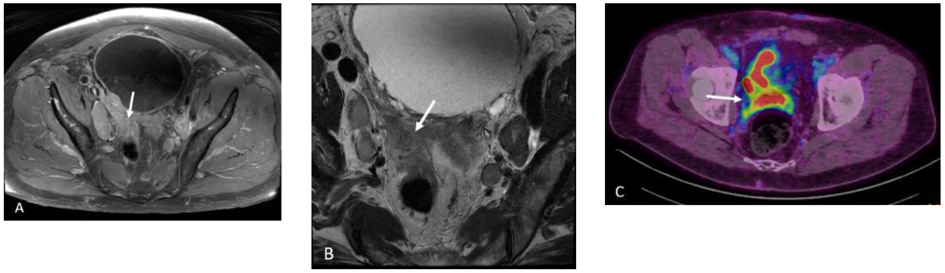 Cancers 15 00796 g014