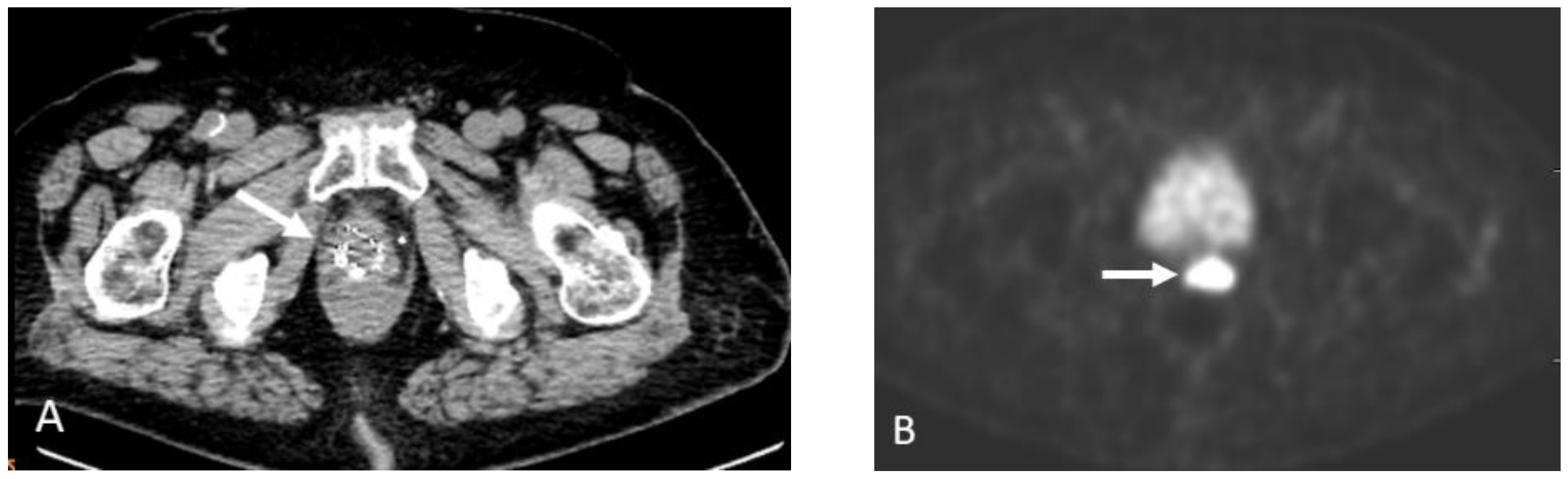 Cancers 15 00796 g017