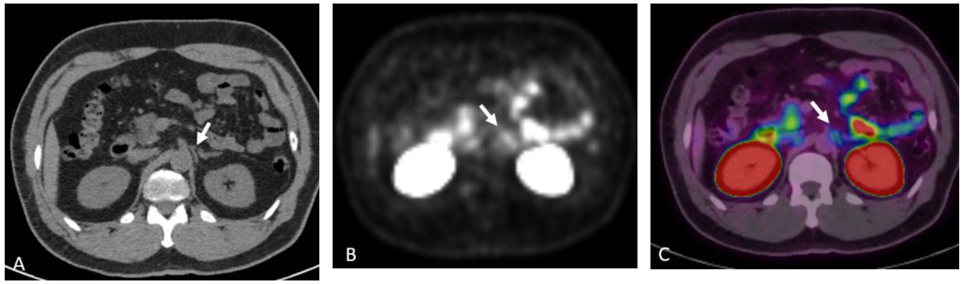 Cancers 15 00796 g018