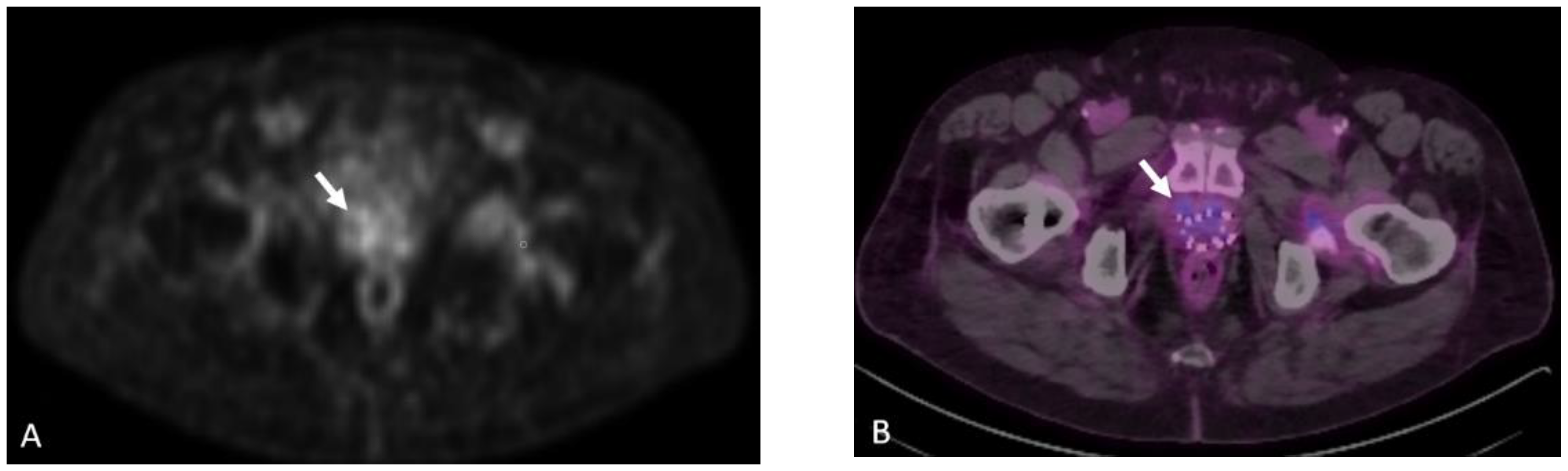 Cancers 15 00796 g020