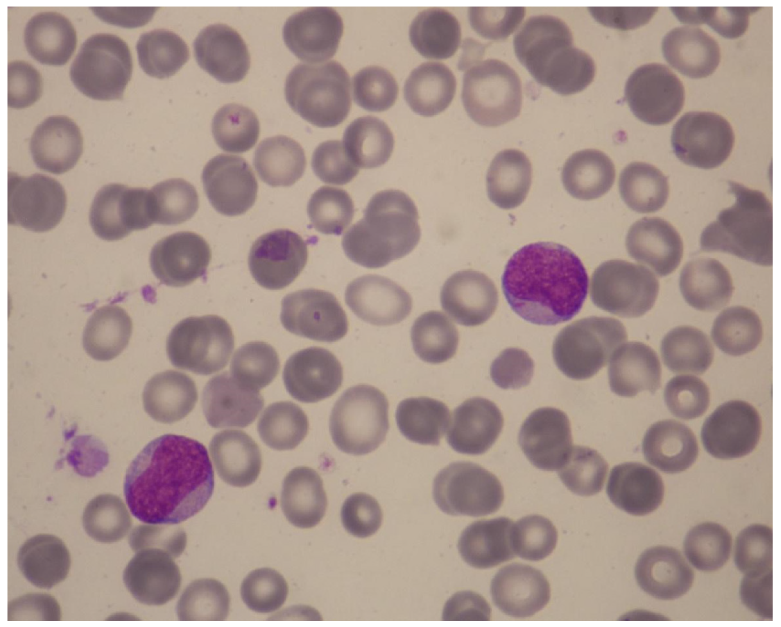 Cancers 15 01658 g005