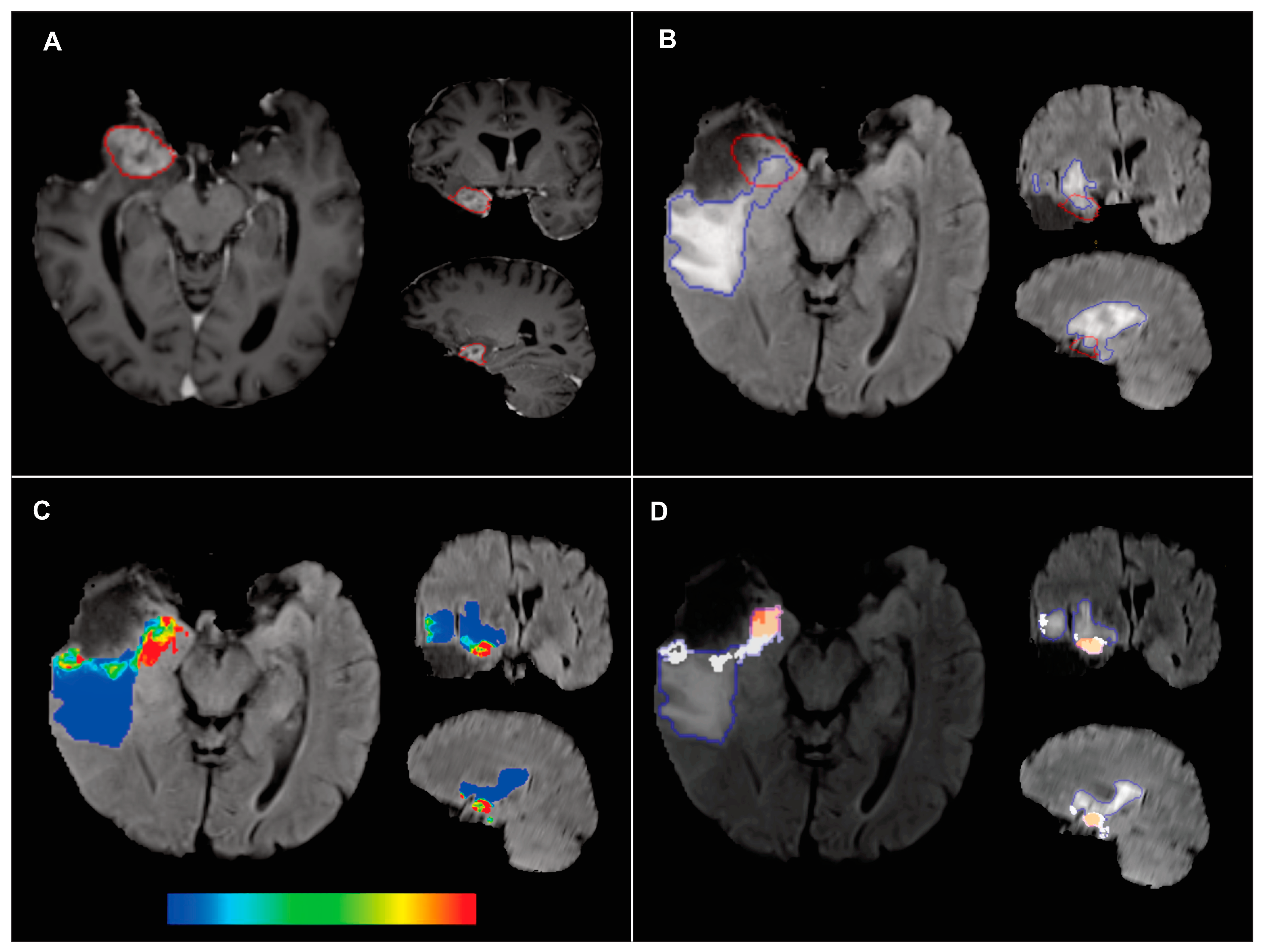 Cancers 15 01894 g001