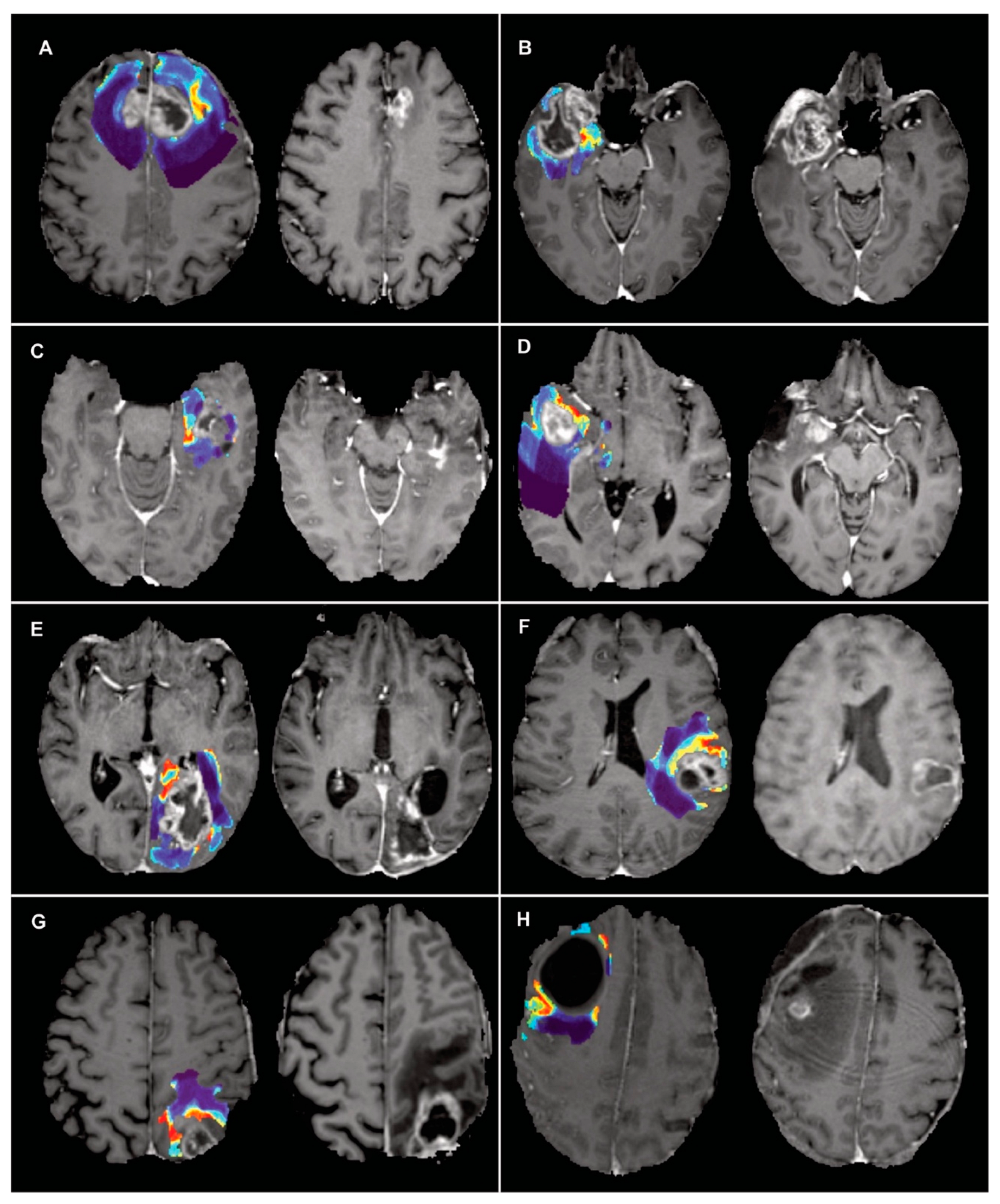 Cancers 15 01894 g007