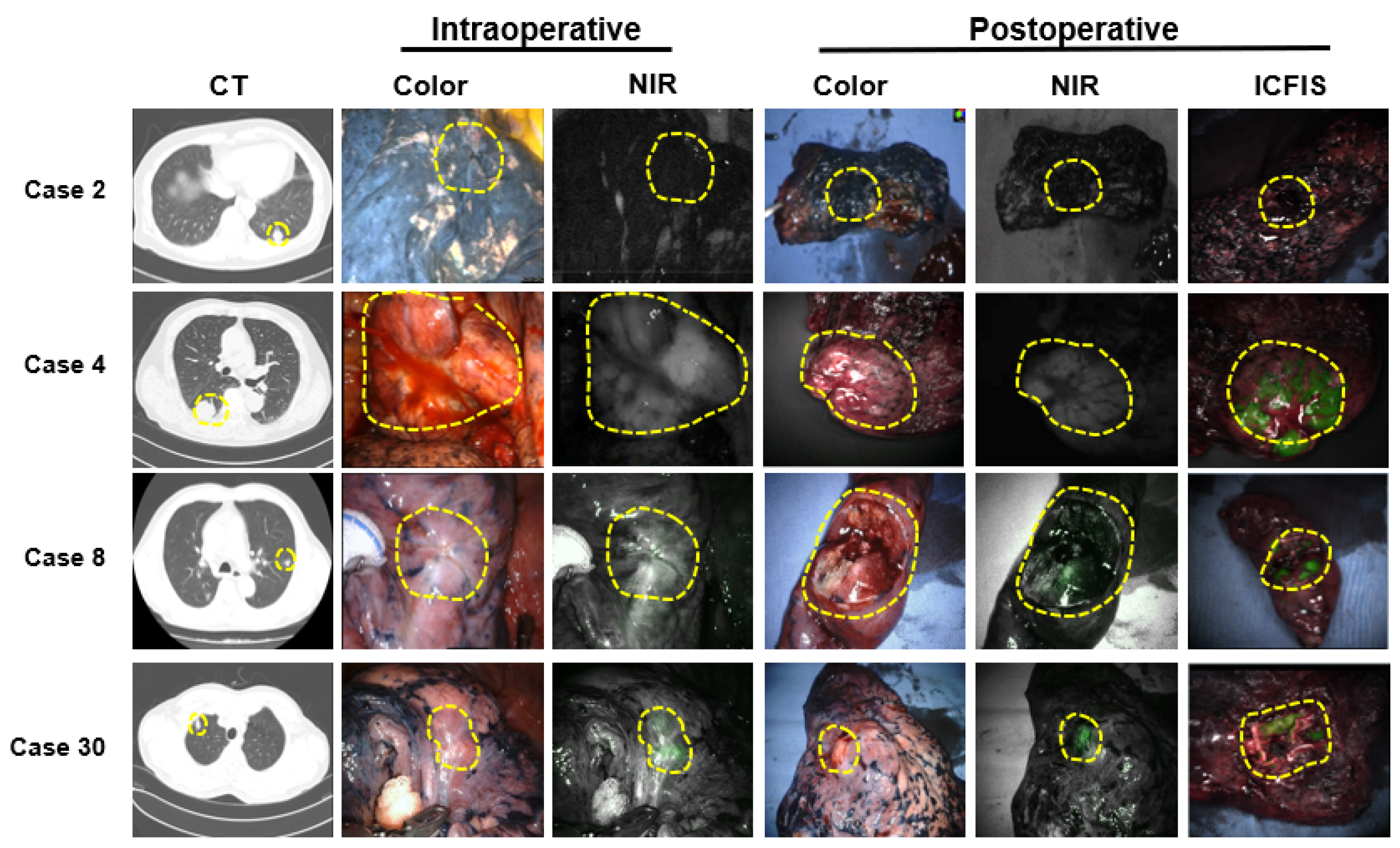 Cancers 15 03643 g006