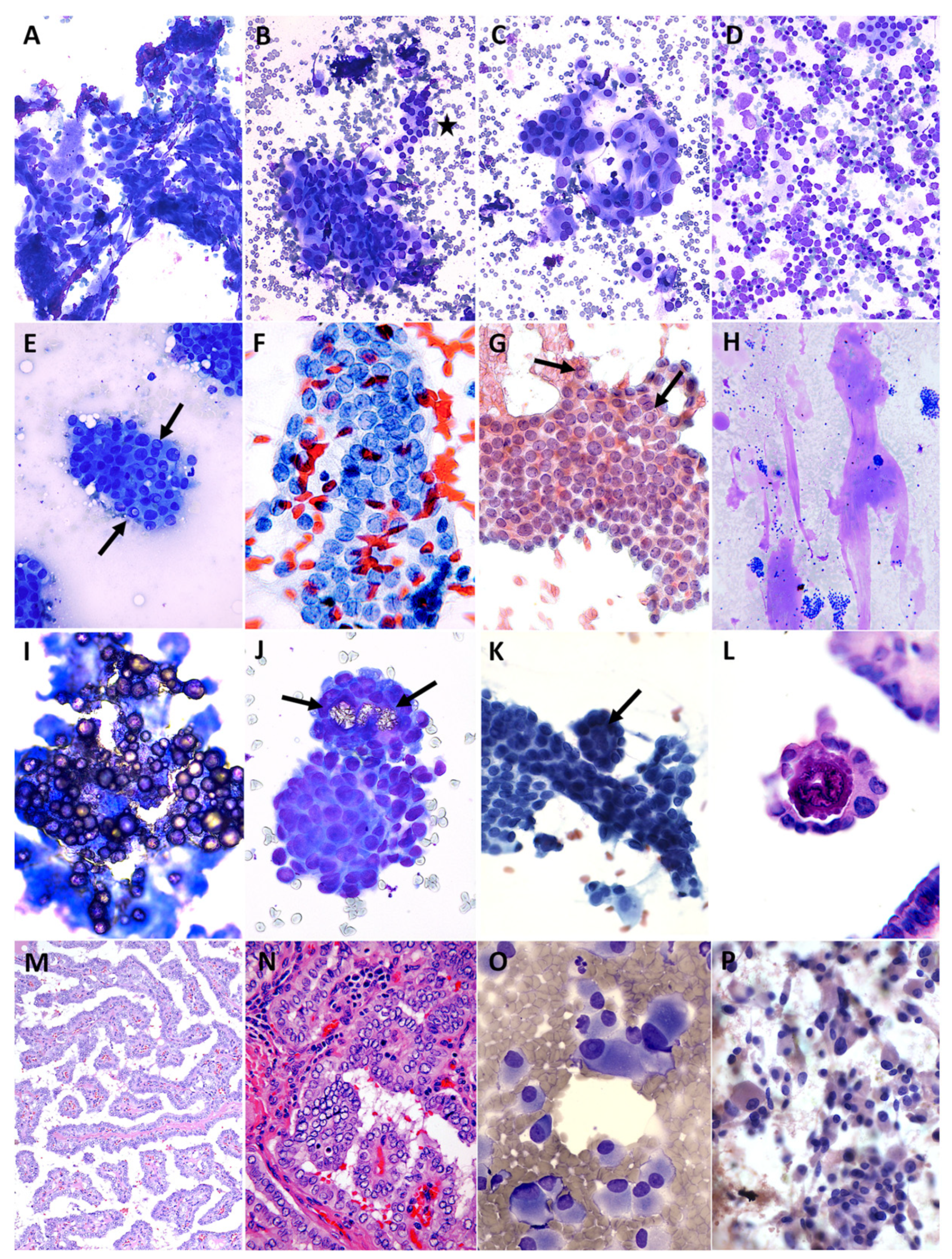 Cancers 15 03975 g003