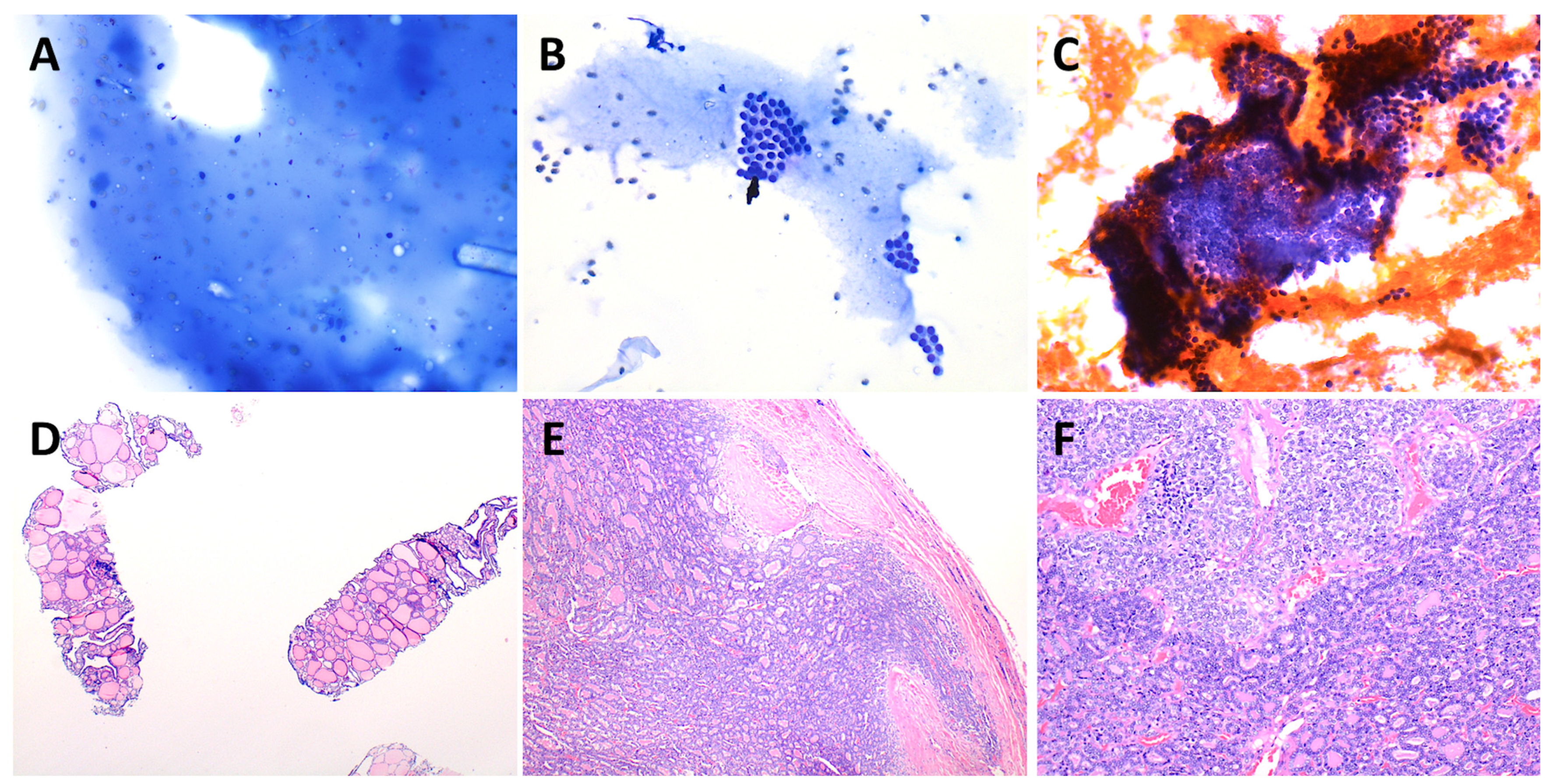 Cancers 15 03975 g004