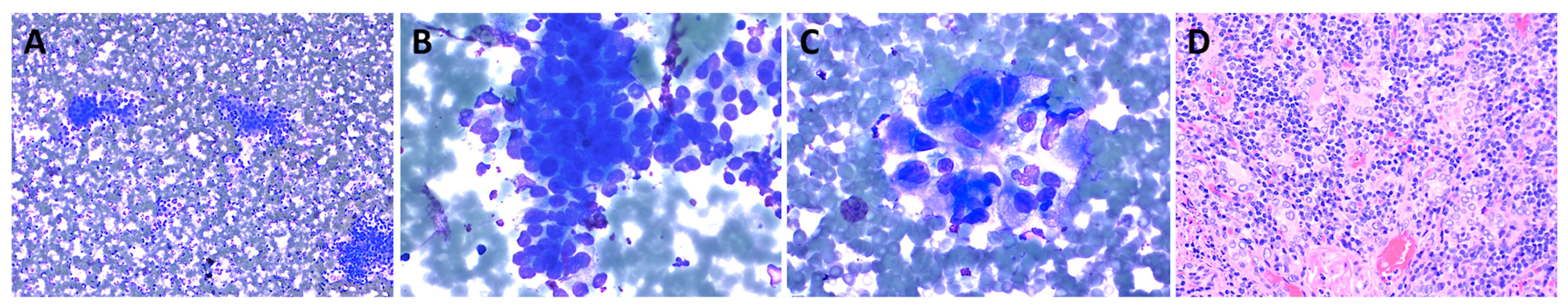 Cancers 15 03975 g005