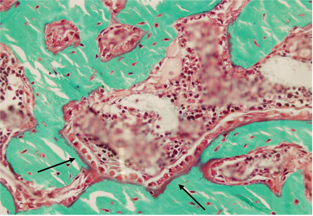 Cells 01 01168 g005 1024