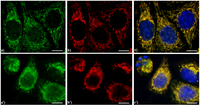 Cells 02 00294 g006 200