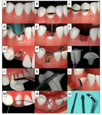 Dentistry 02 00011 g001 200