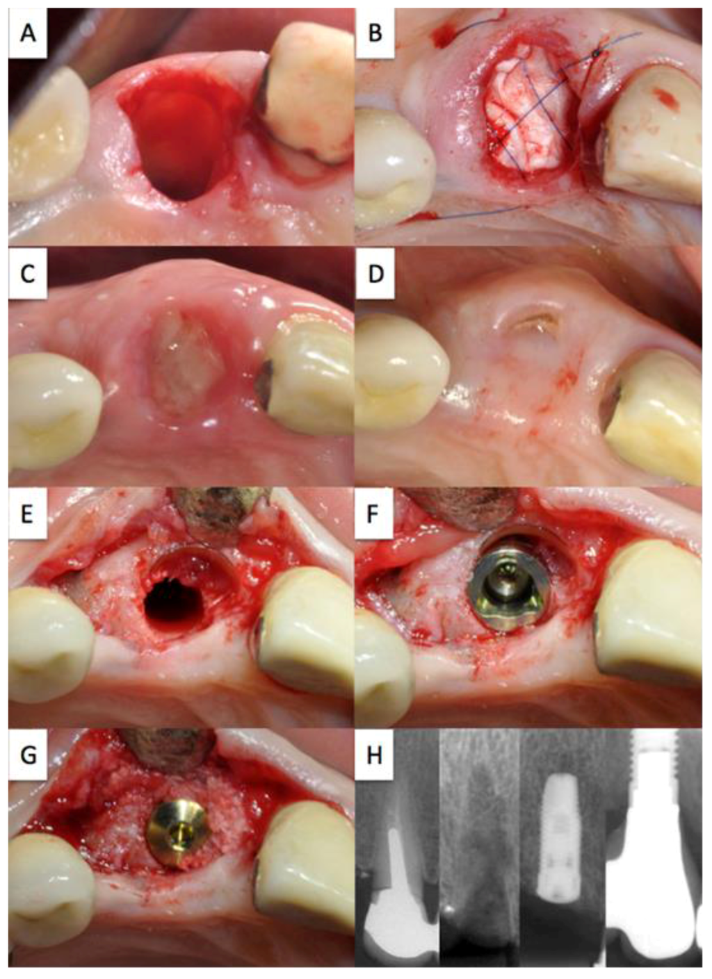 Dentistry 02 00011 g002 1024