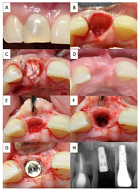 Dentistry 02 00011 g003 200