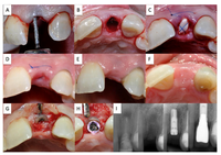 Dentistry 02 00011 g004 200