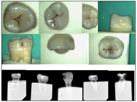Dentistry 02 00041 g002 200