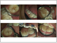 Dentistry 02 00041 g003 200