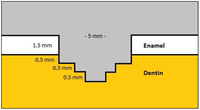 Dentistry 02 00052 g001 200