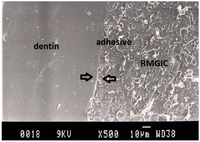Dentistry 02 00052 g007 200
