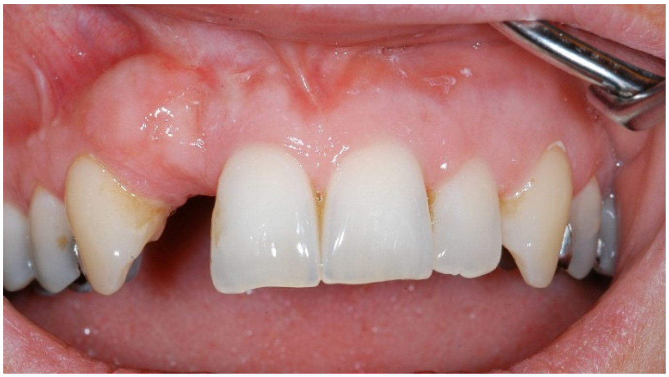 Dentistry 02 00106 g004