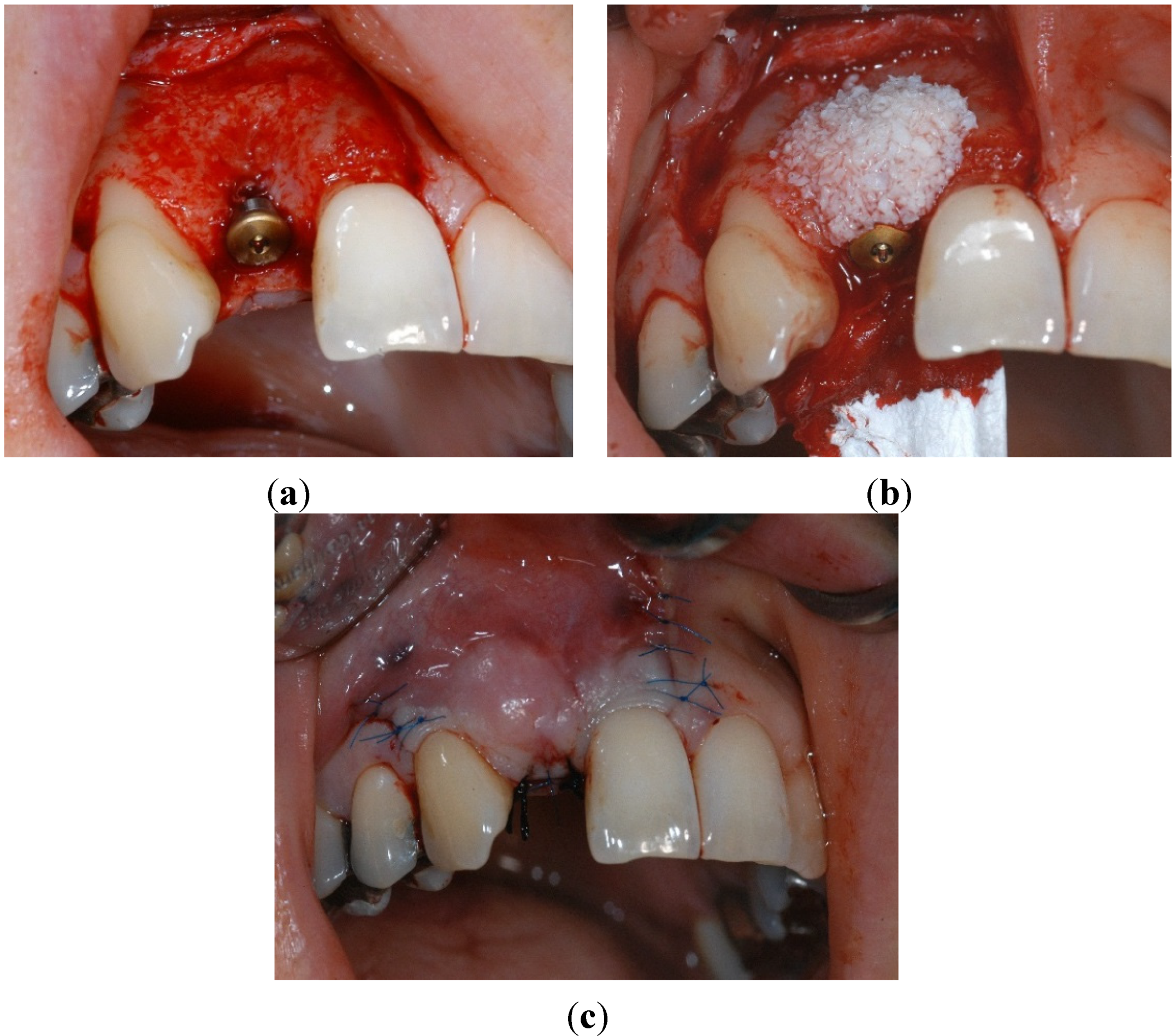 Dentistry 02 00106 g005