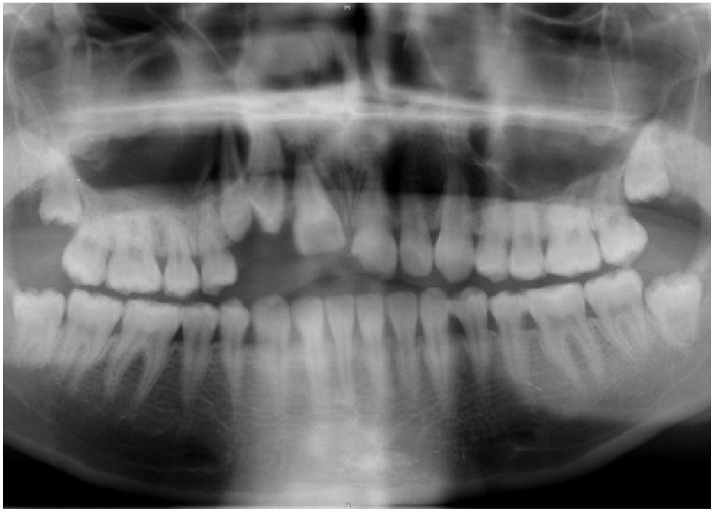 Free dental radiography essay