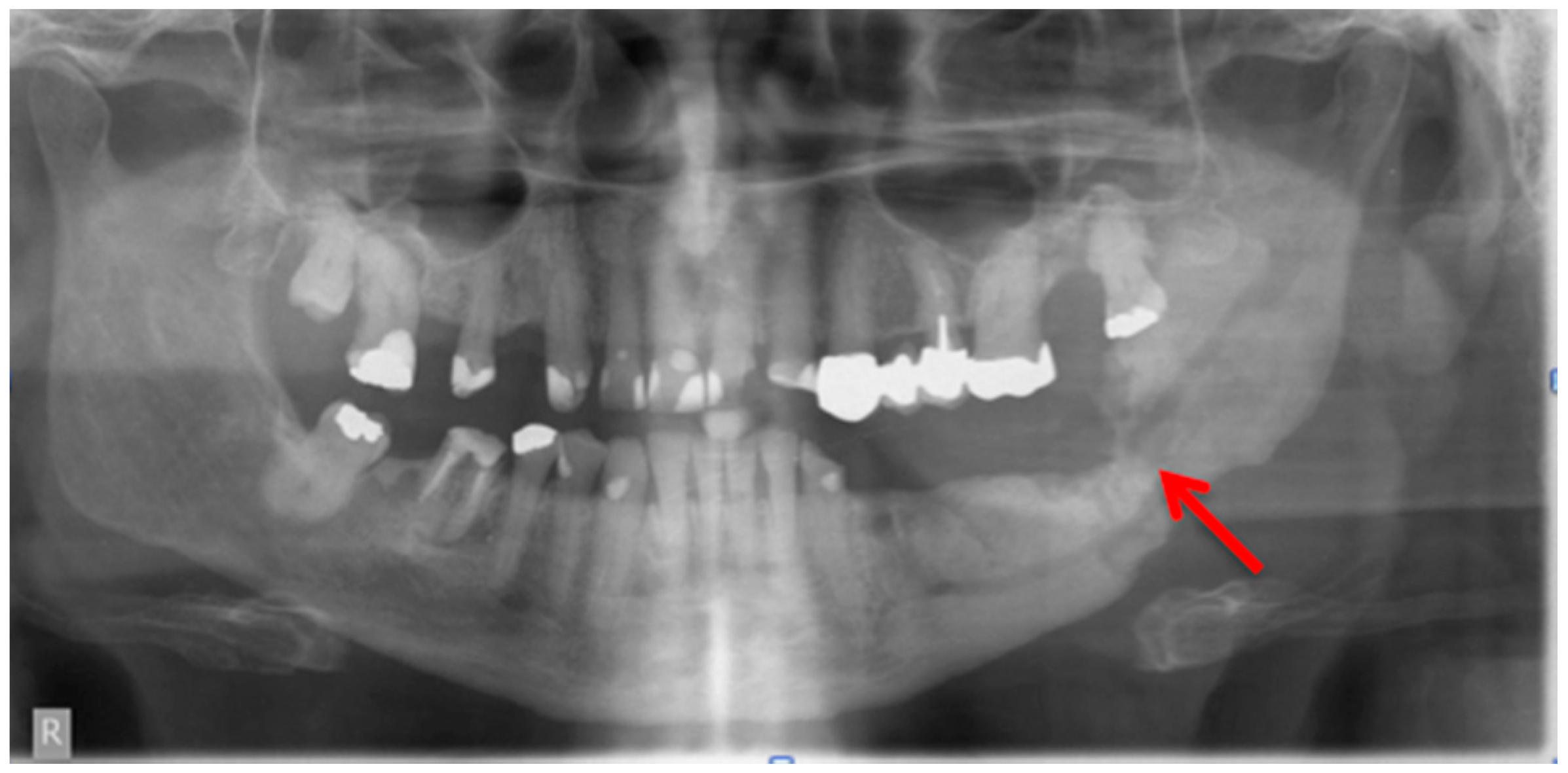 Free dental radiography essay