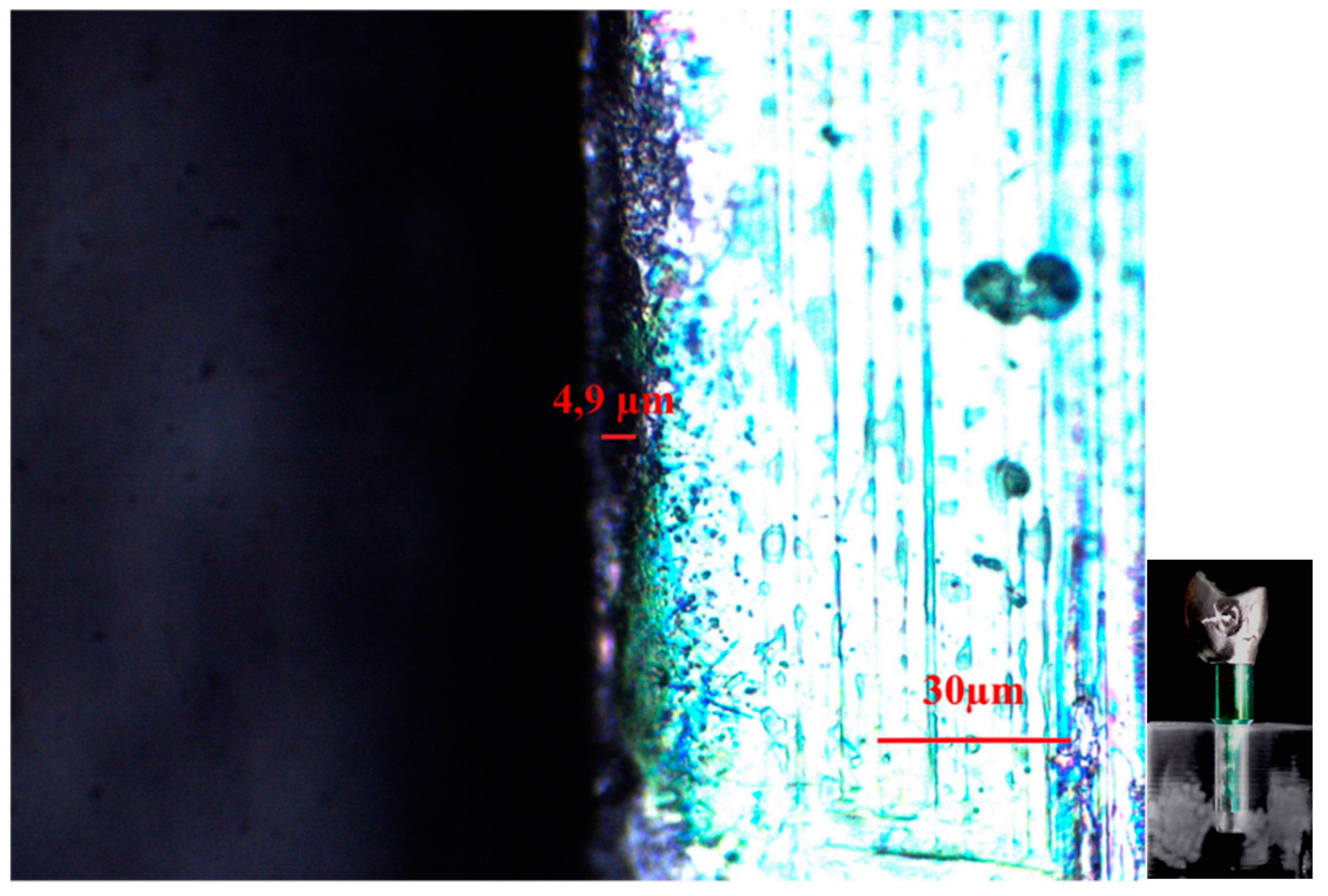 Dentistry 04 00031 g005