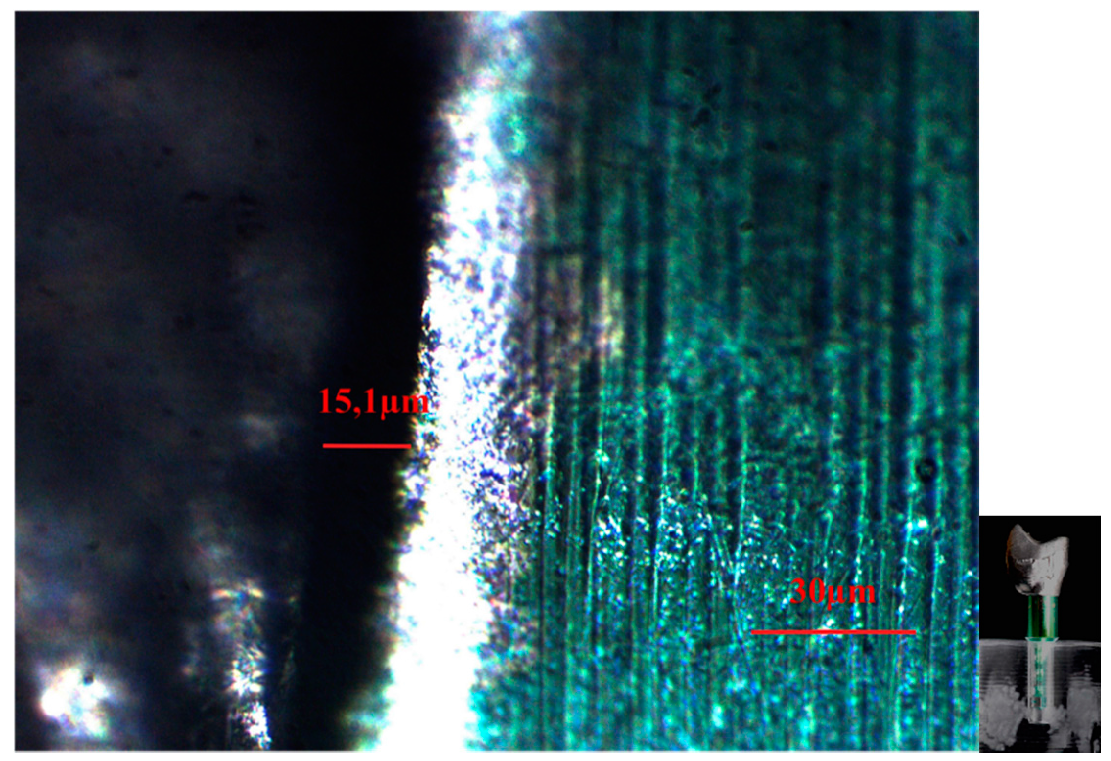 Dentistry 04 00031 g006