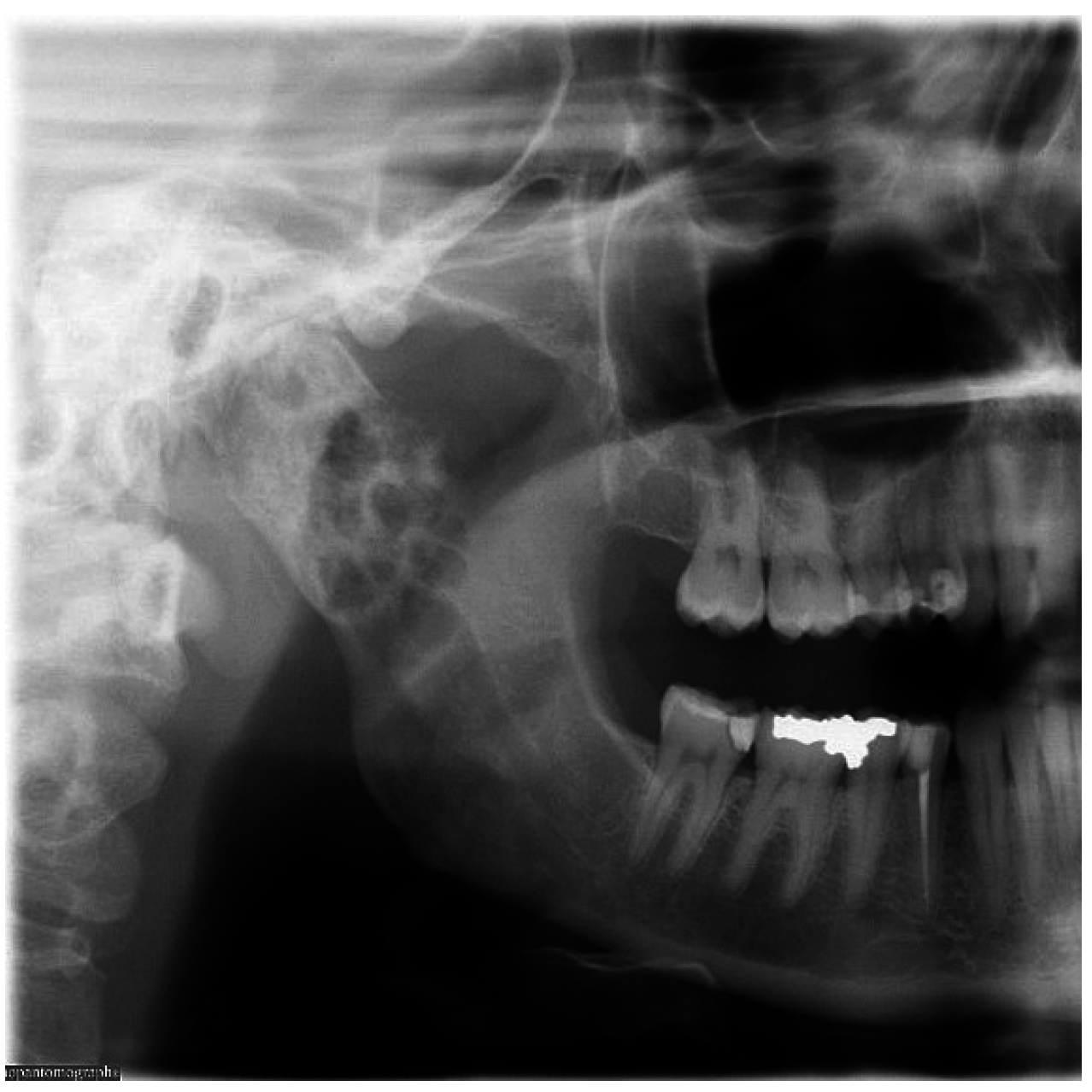 Free dental radiography essay