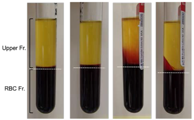 Dentistry 05 00007 i001