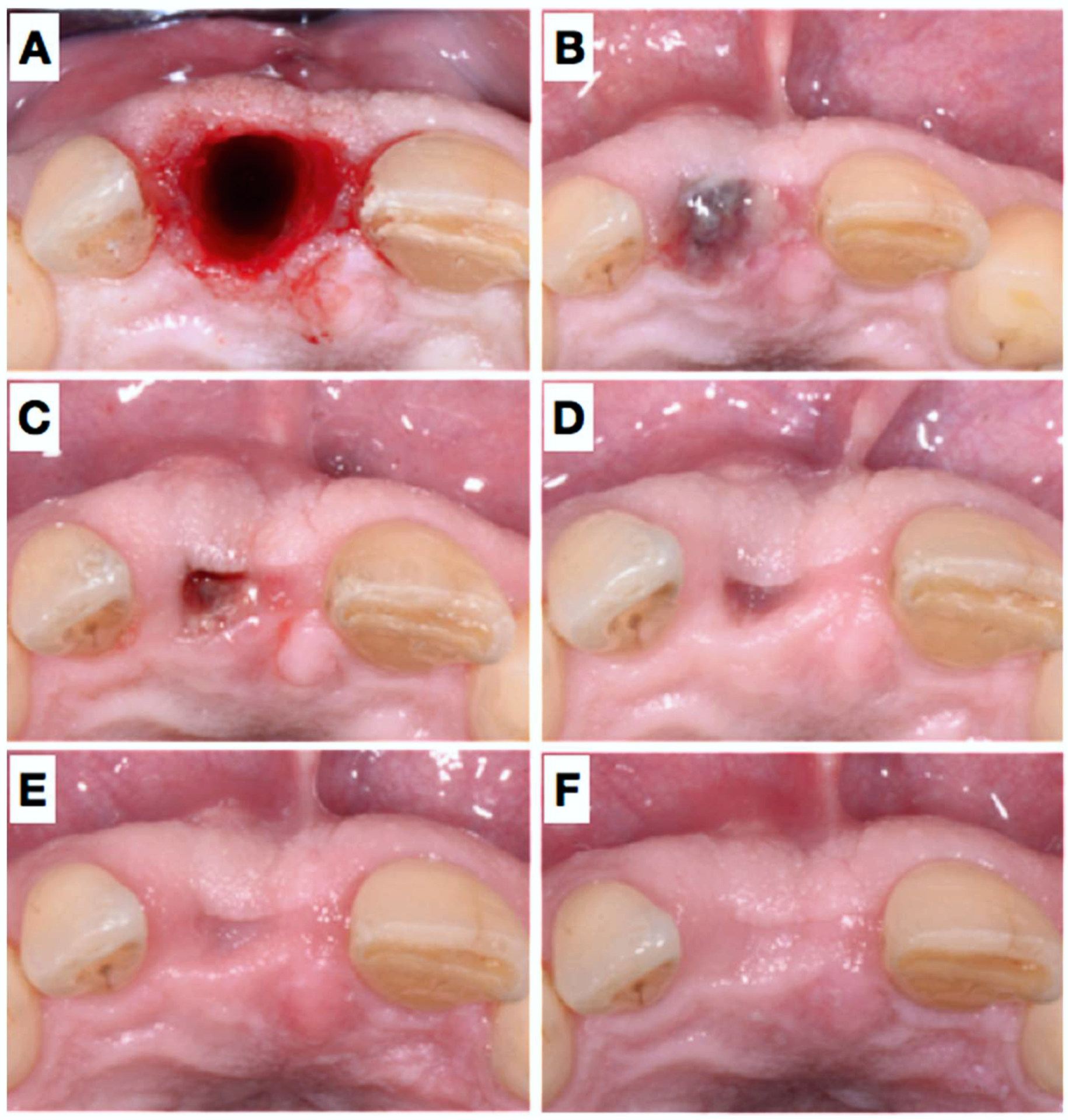 Dentistry 06 00021 g002