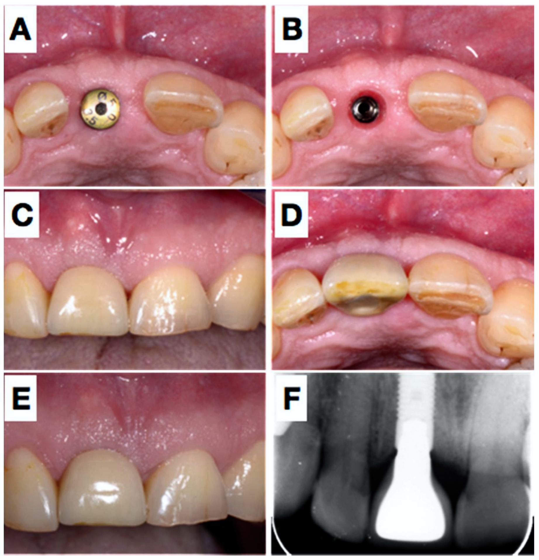 Dentistry 06 00021 g005