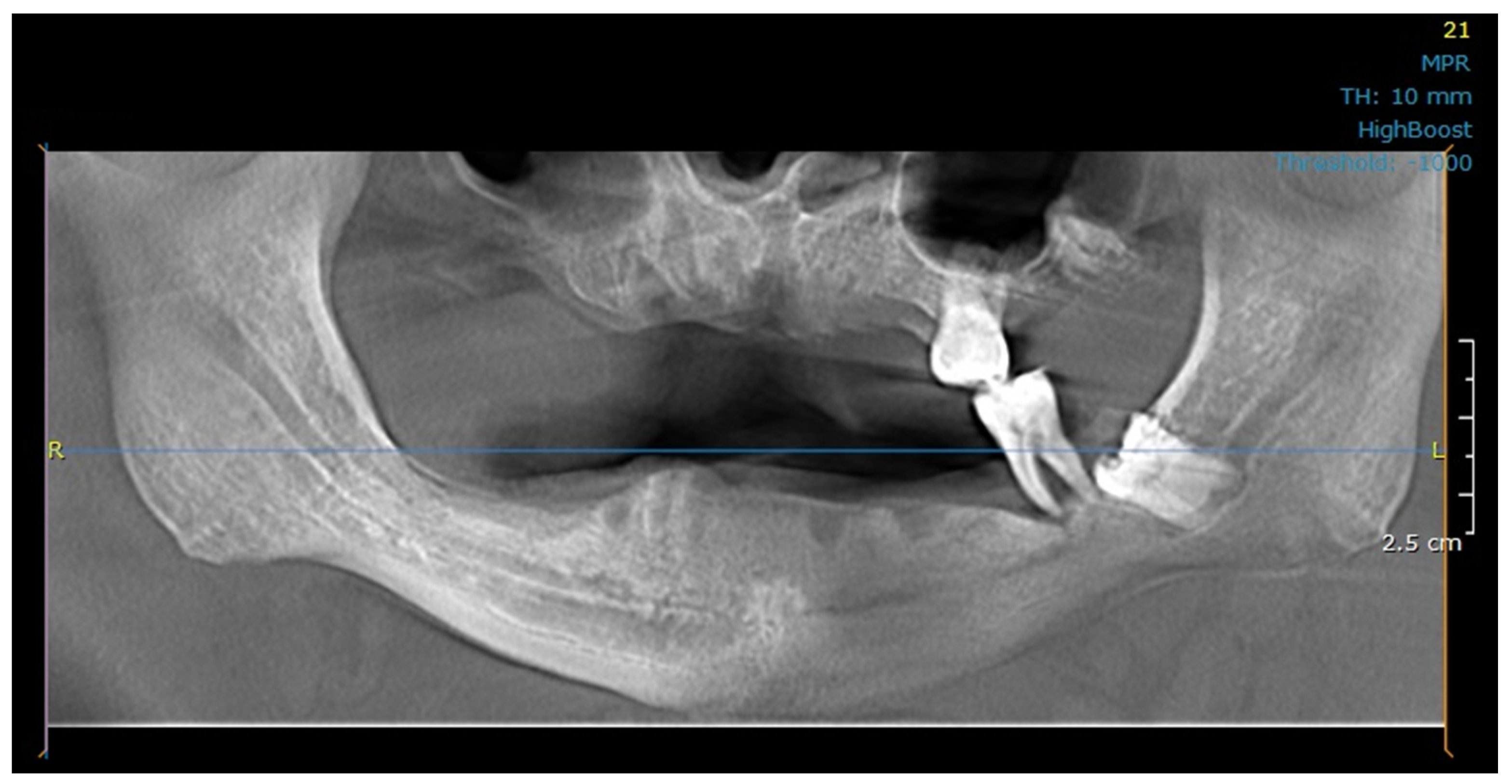 Dentistry 11 00261 g001