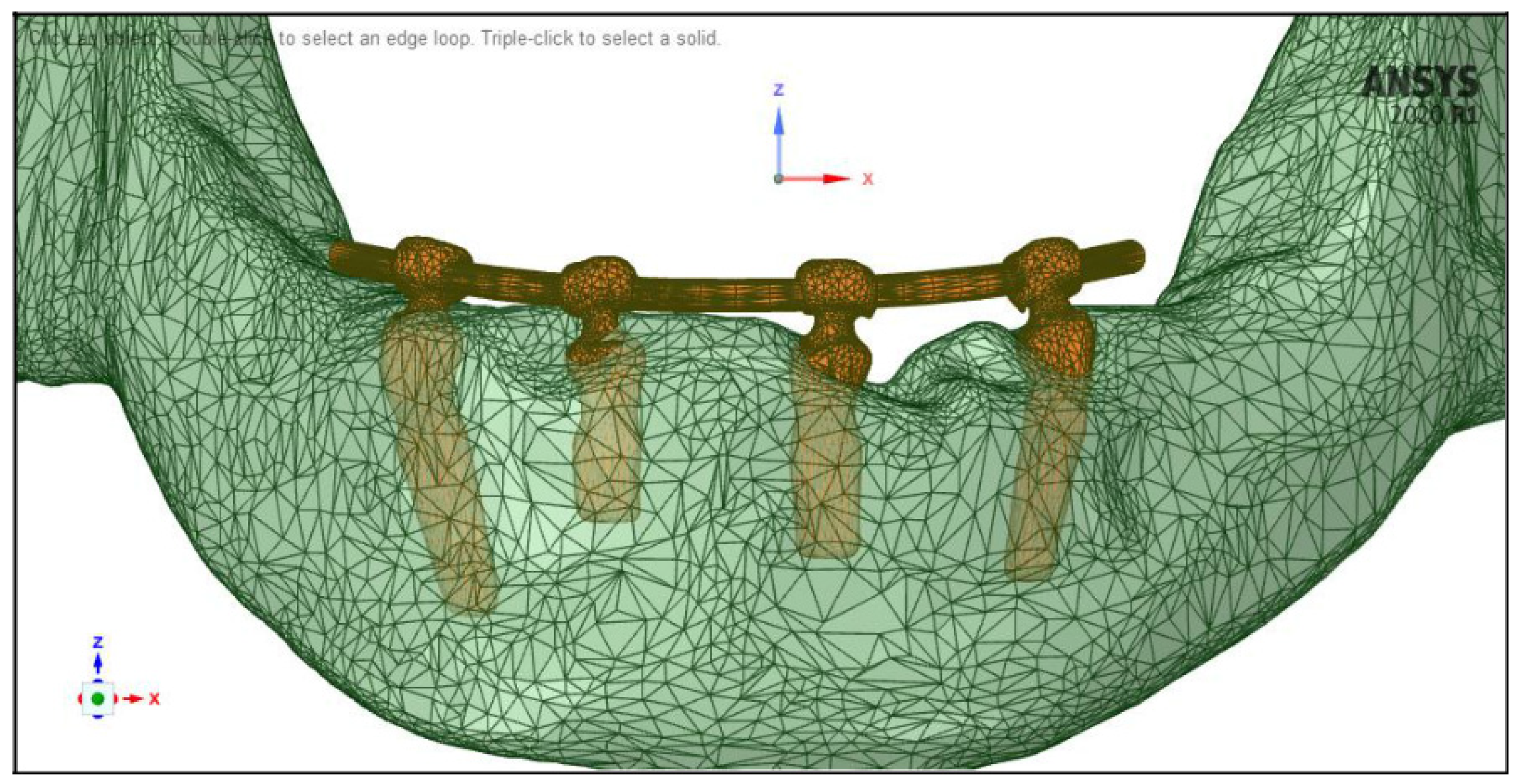 Dentistry 11 00261 g004