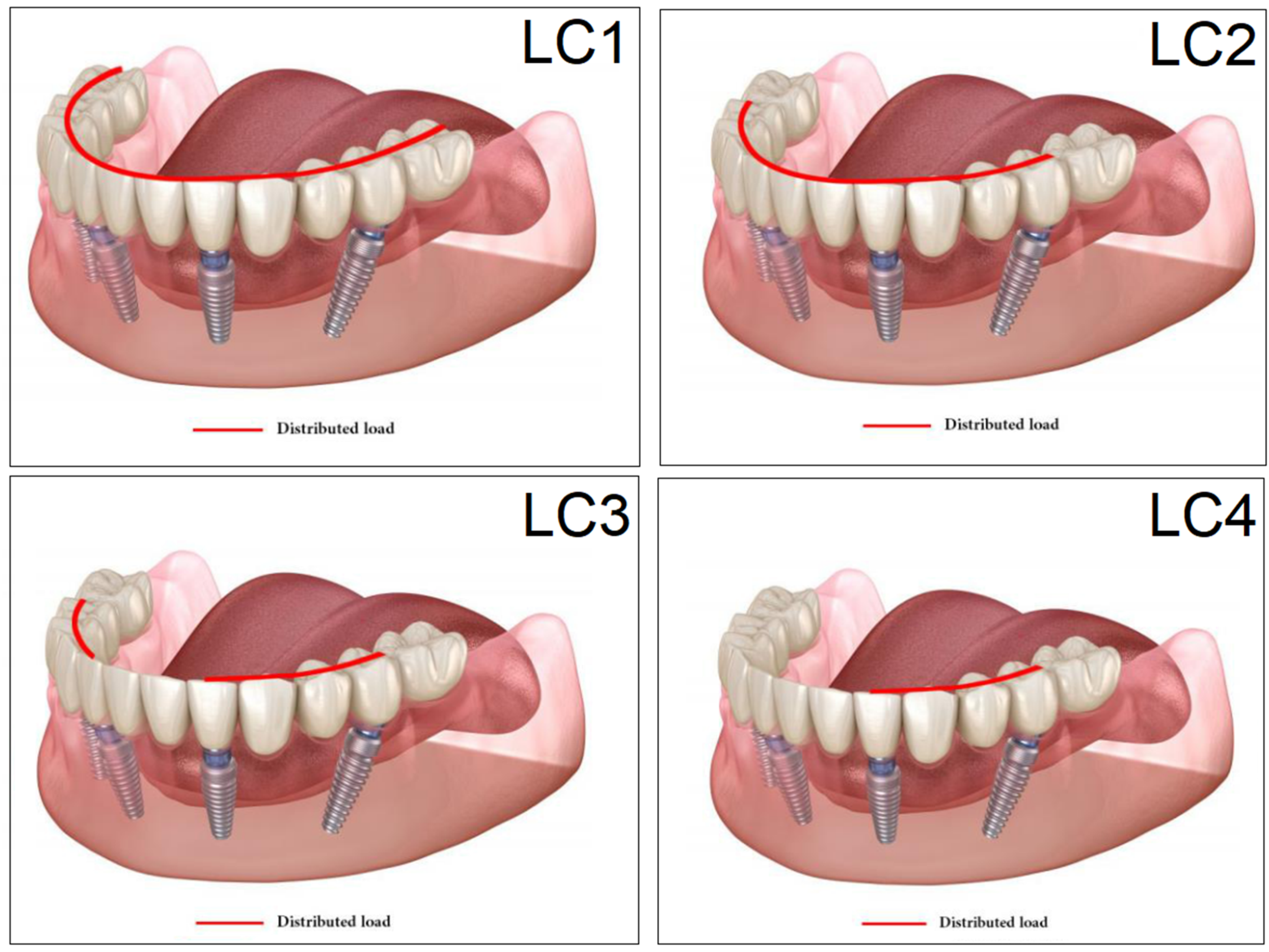 Dentistry 11 00261 g005
