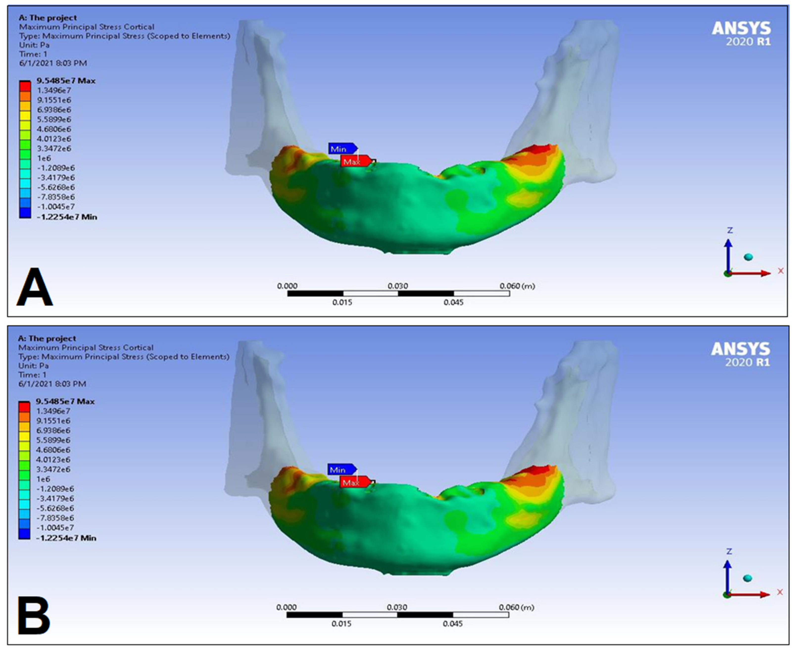 Dentistry 11 00261 g011