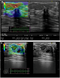 Diagnostics 03 00117 g001 200
