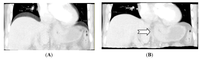 Diagnostics 03 00261 g001 200