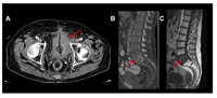 Diagnostics 03 00315 g001 200