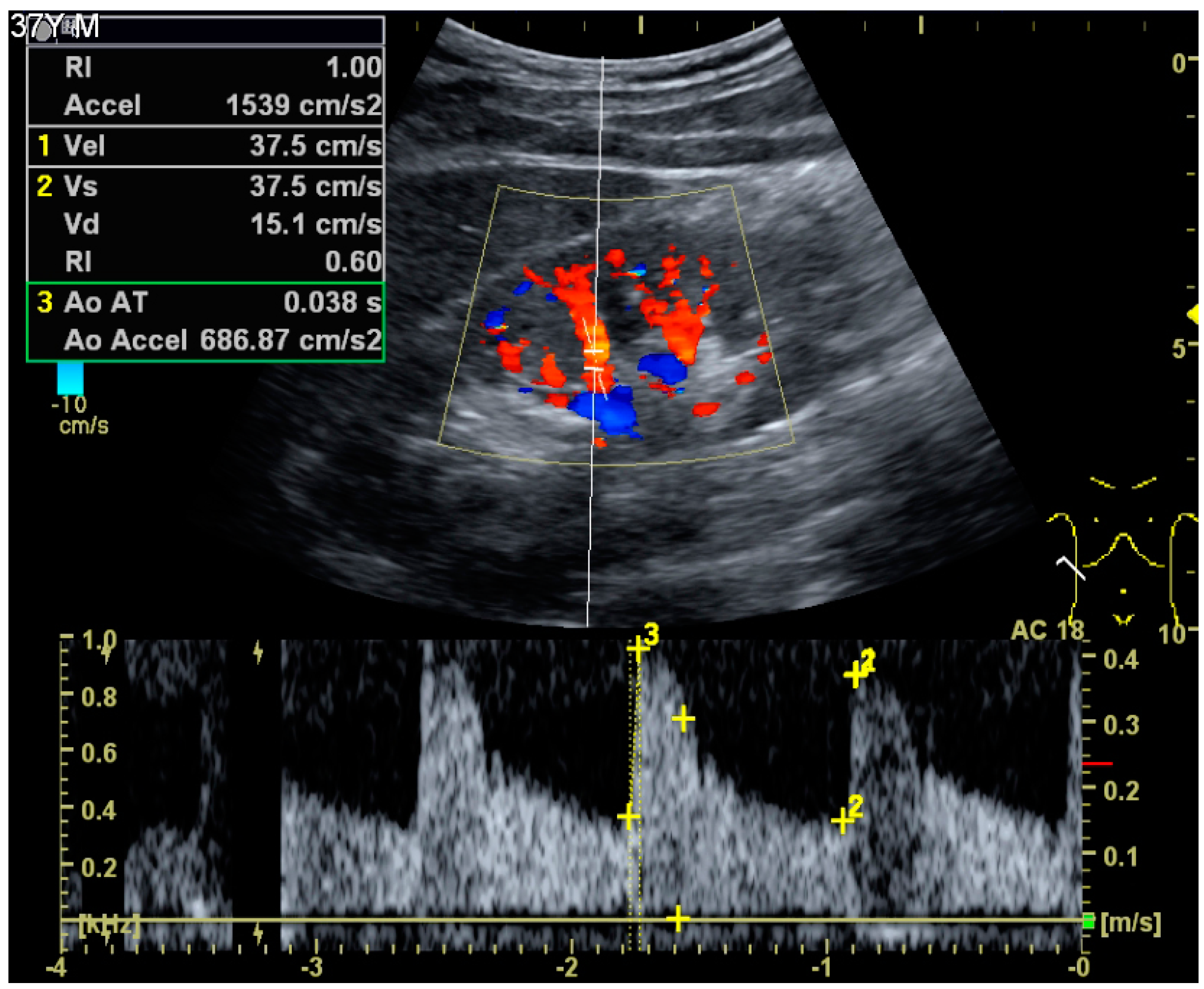 Diagnostics | Free Full-Text | Ultrasonography of the Kidney: A