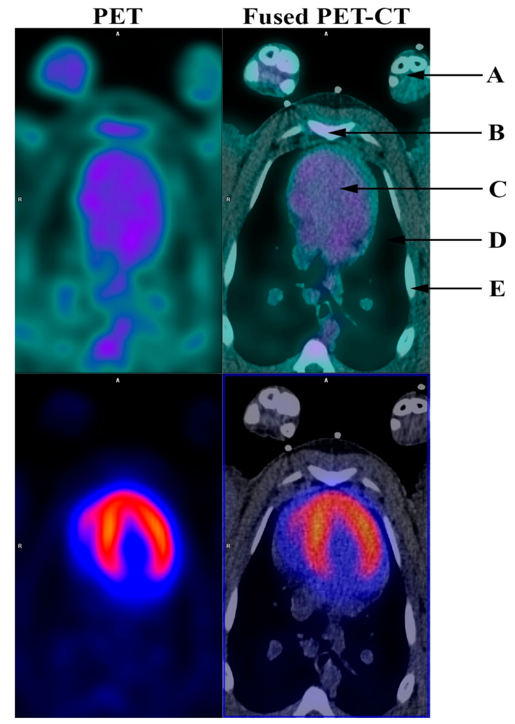 Diagnostics Special Issue Positron Emission Tomography (PET) in