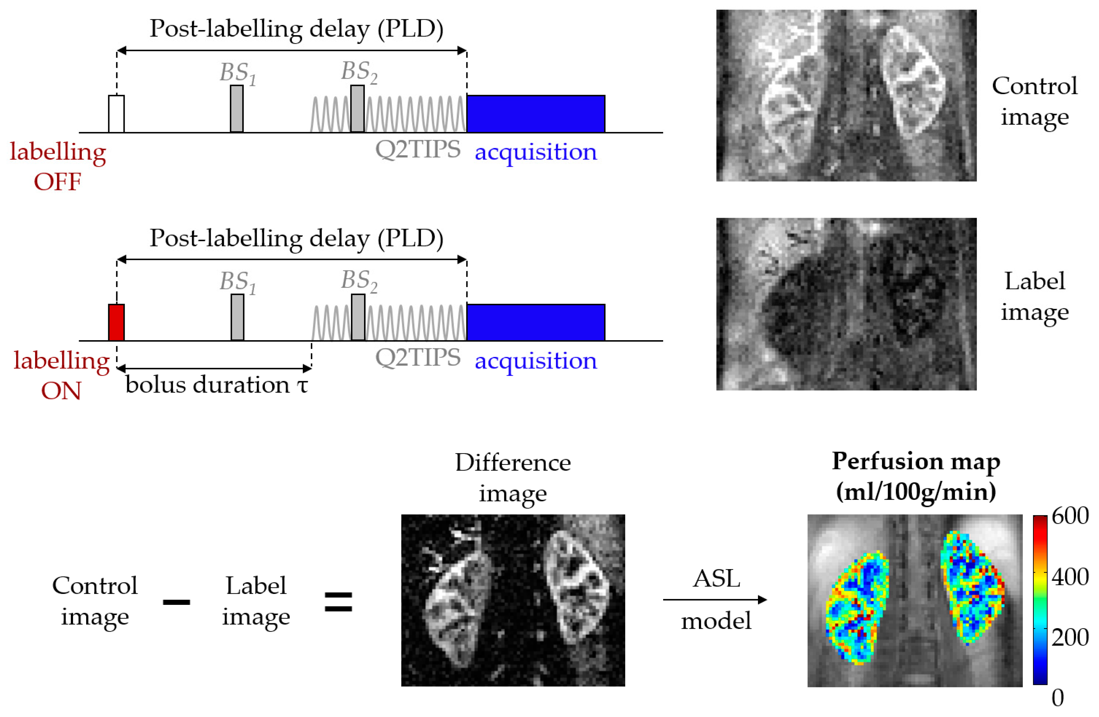 Diagnostics Free FullText NonInvasive Renal Perfusion Imaging