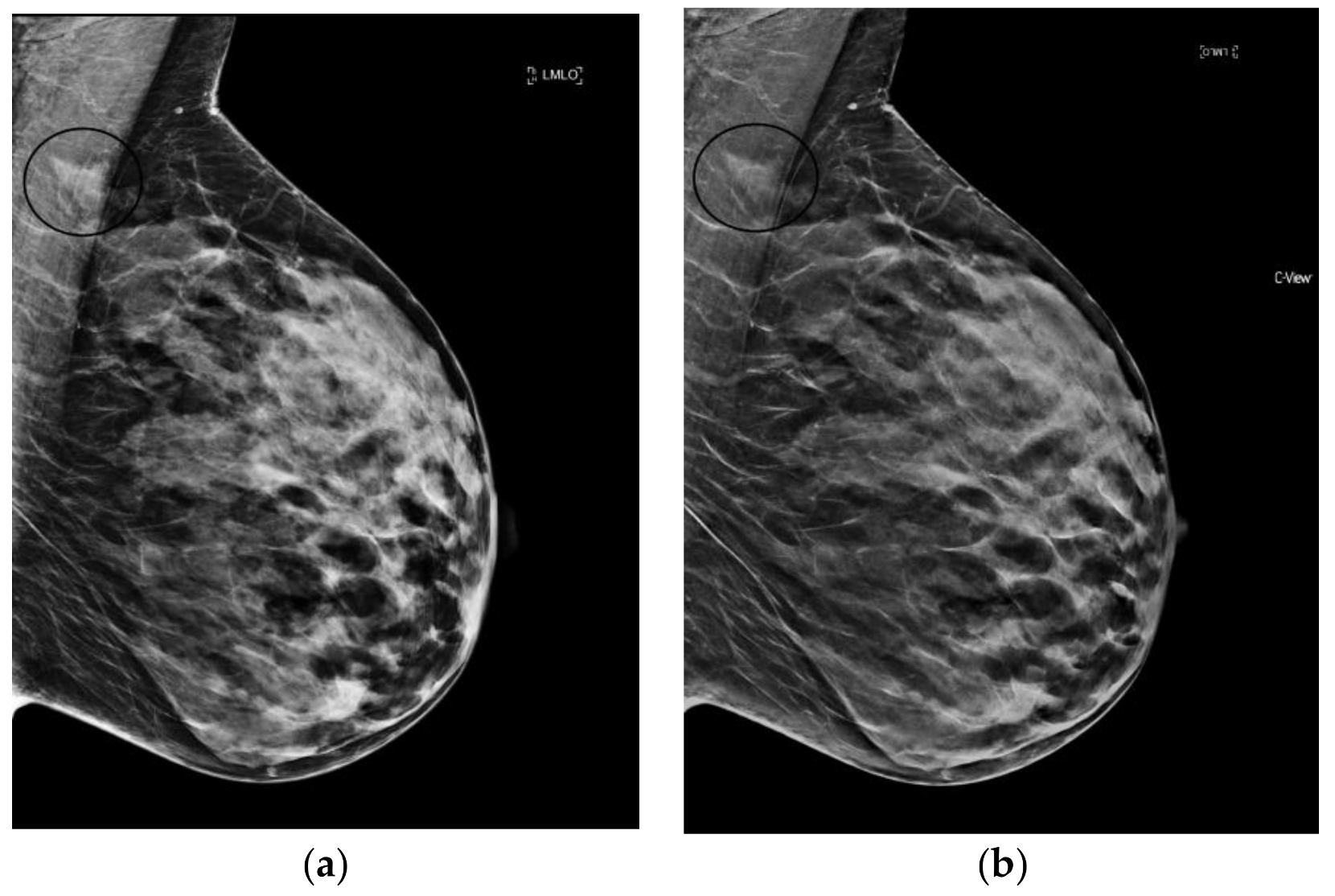 Diagnostics Free Full Text Synthesized Mammography Clinical