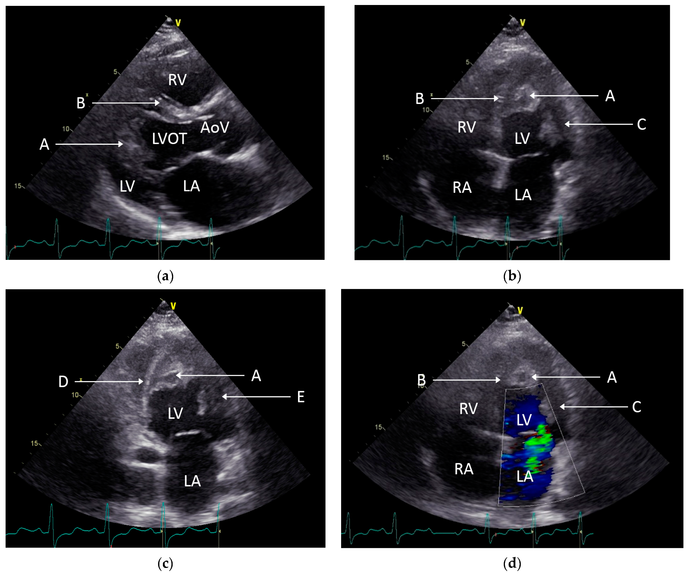 Diagnostics 13 01795 g002
