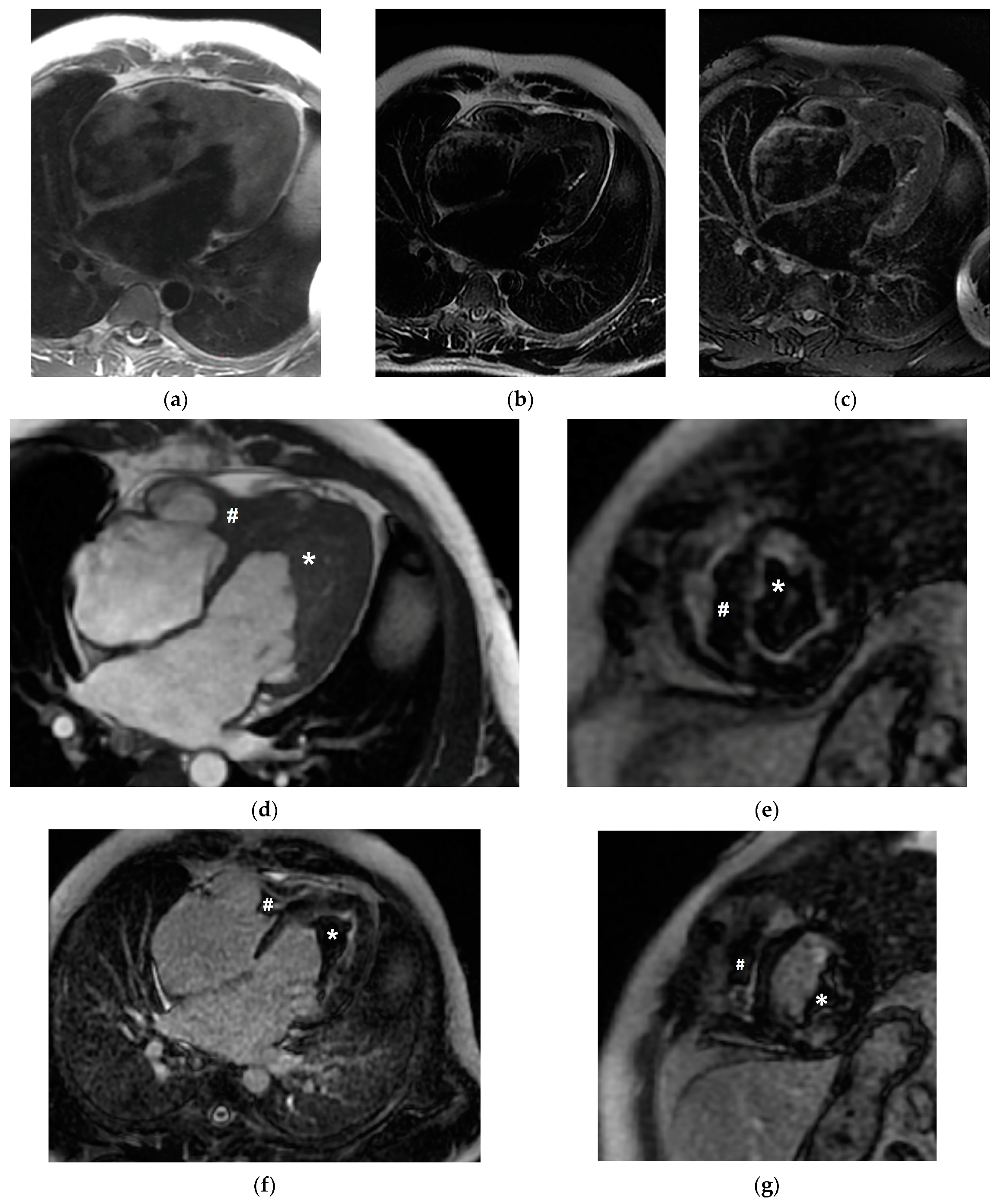 Diagnostics 13 01795 g003