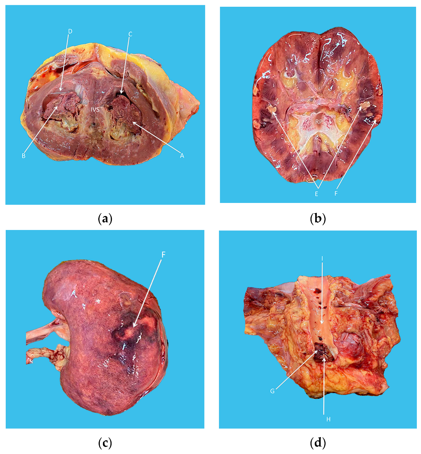 Diagnostics 13 01795 g004