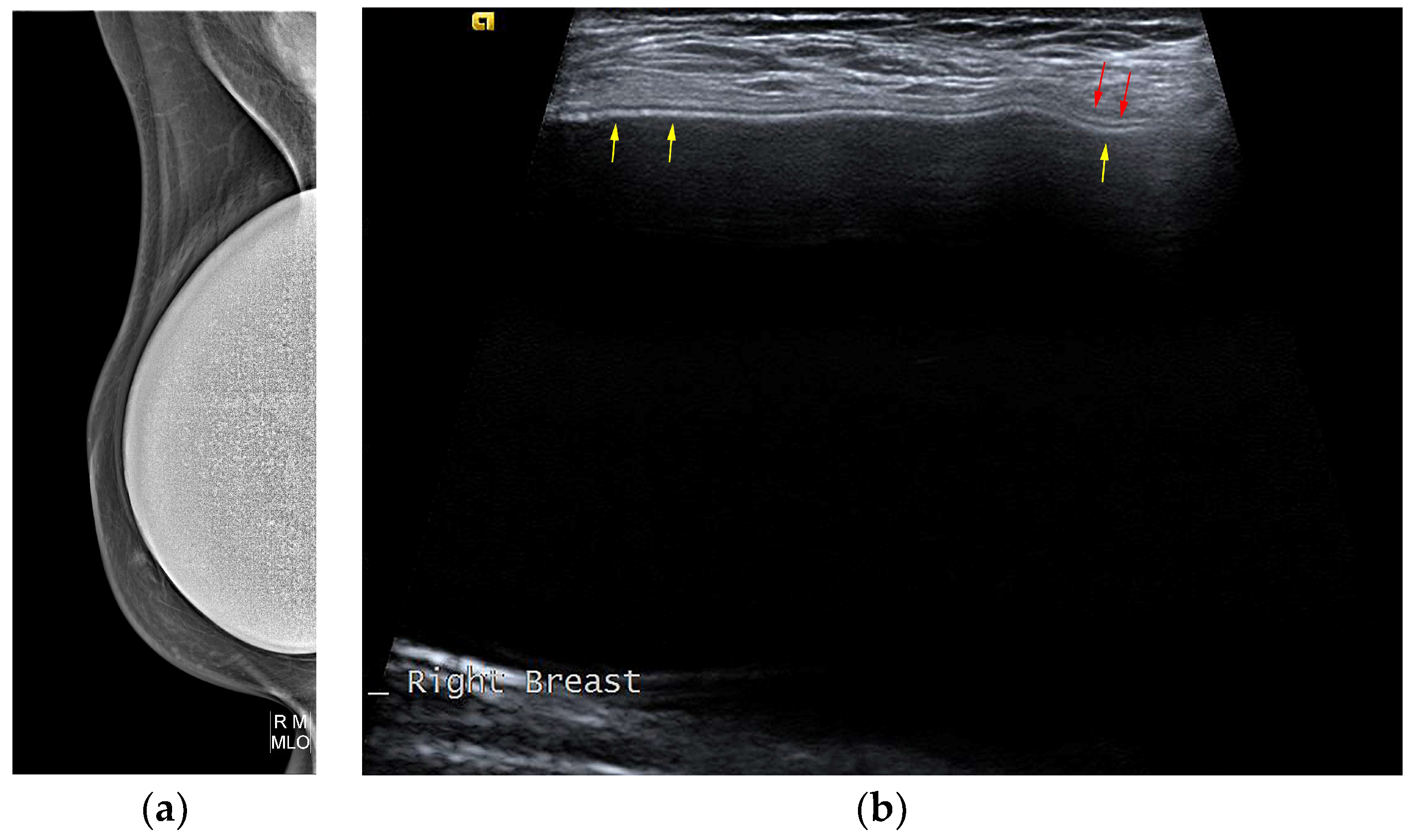 Diagnostics 13 03186 g008