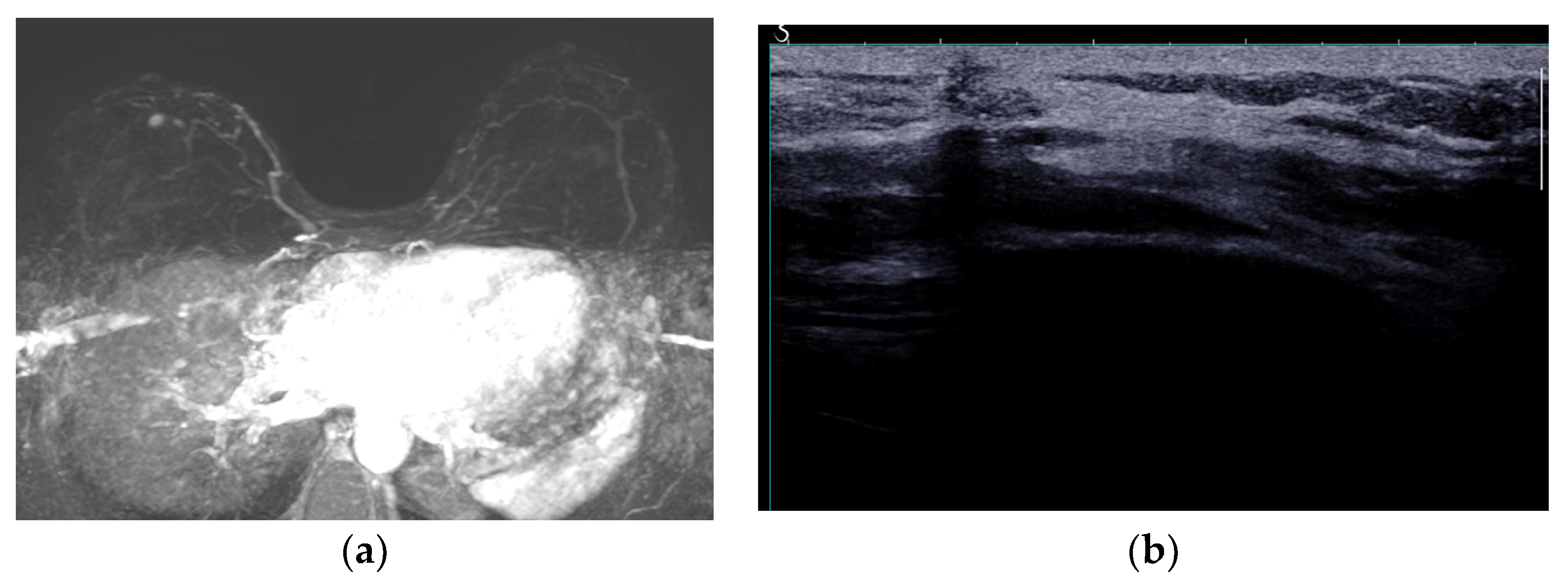 Diagnostics 13 03186 g020